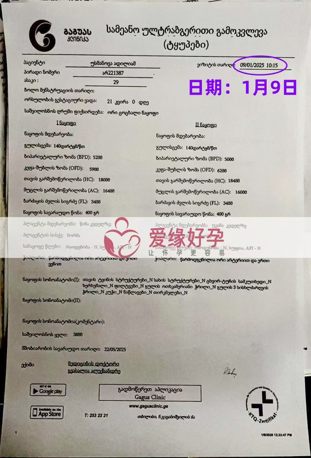 格鲁吉亚爱心使者孕21周产检顺利通过