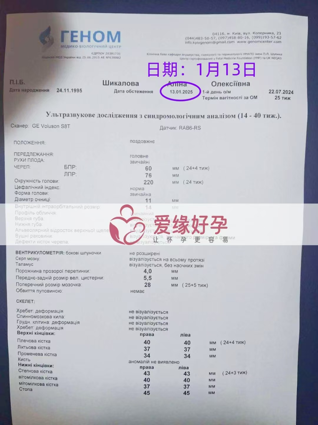 乌克兰爱心使者孕24周产检顺利通过