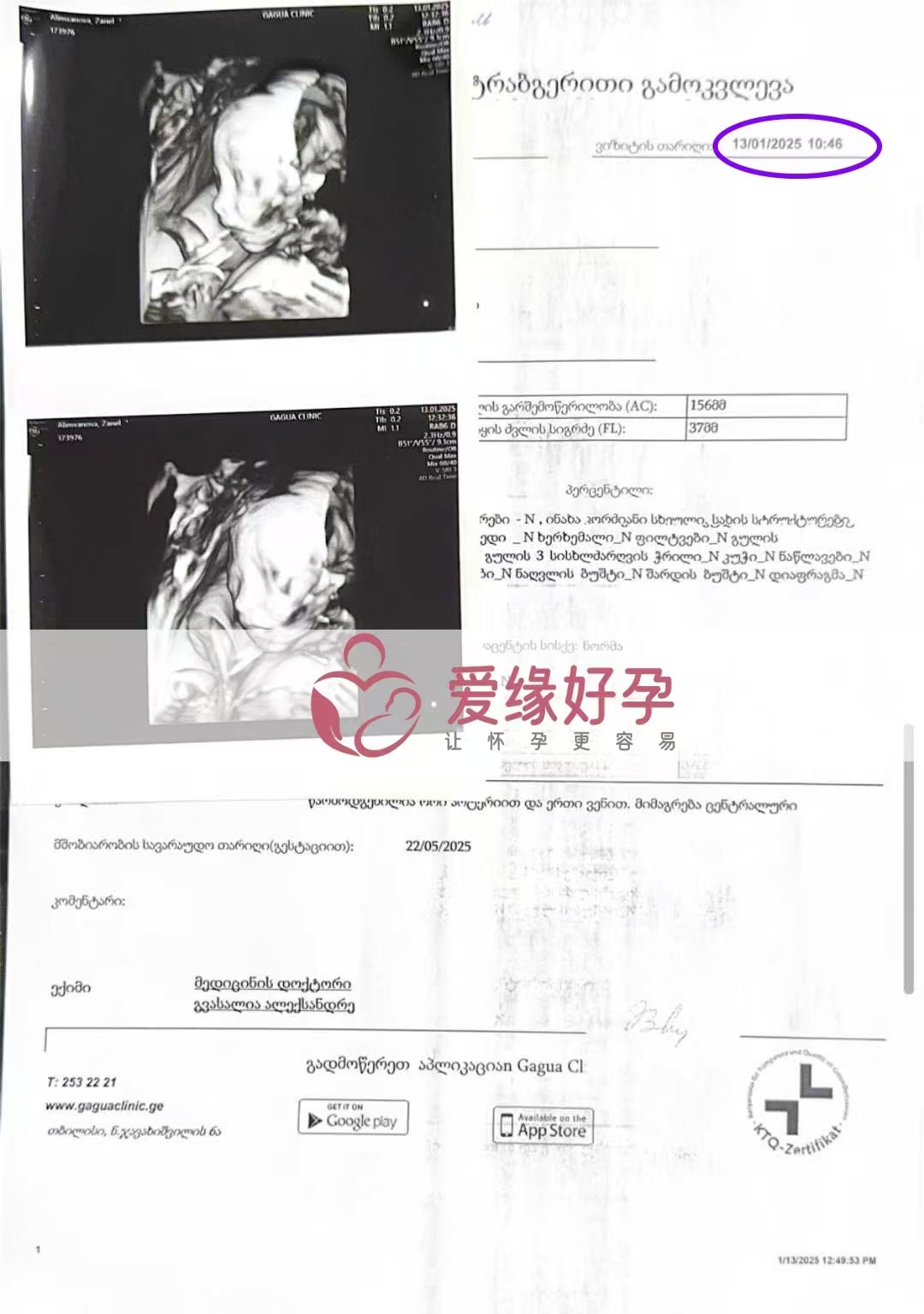 格鲁吉亚爱心使者孕21周产检顺利通过