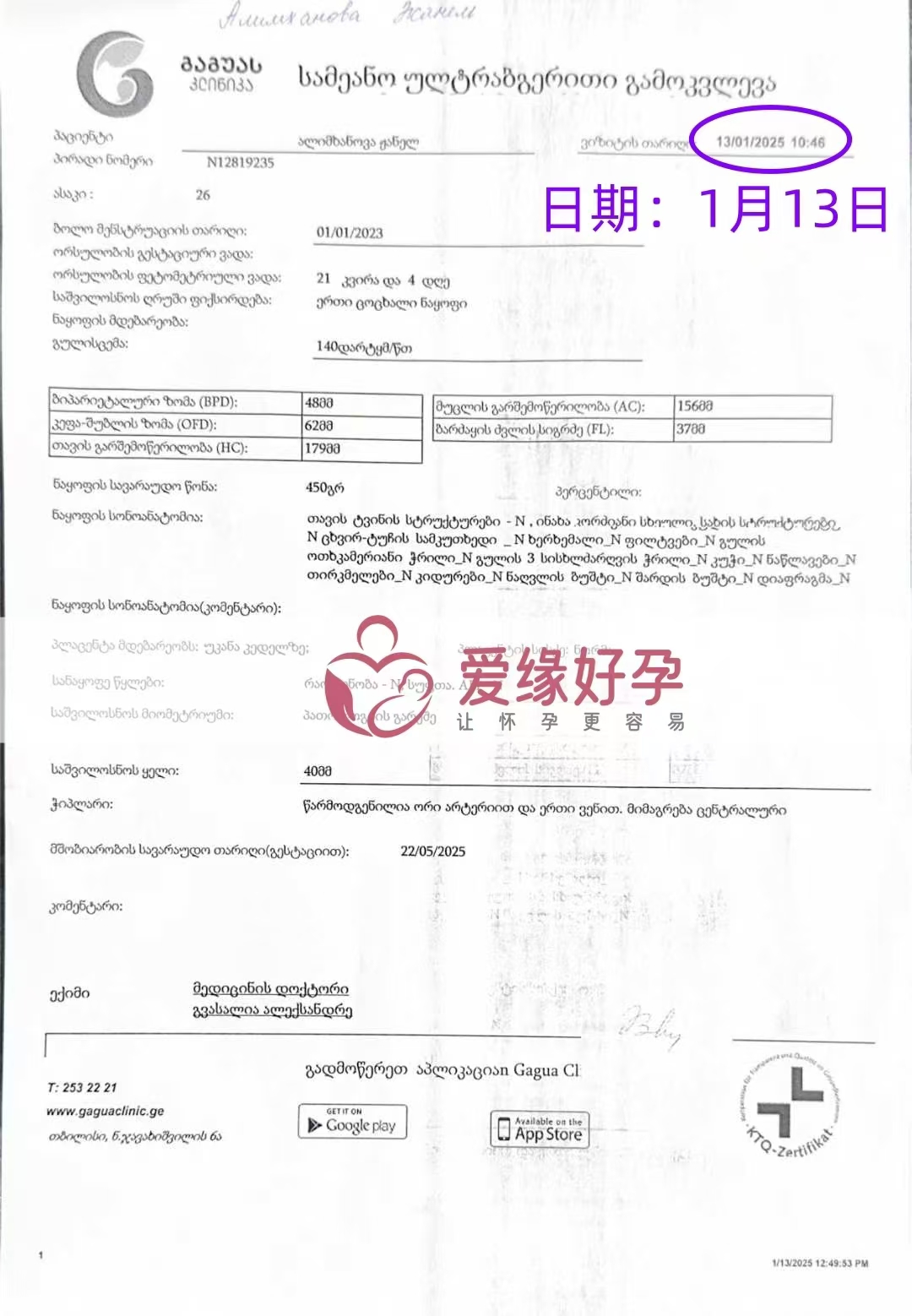 格鲁吉亚爱心使者孕21周产检顺利通过