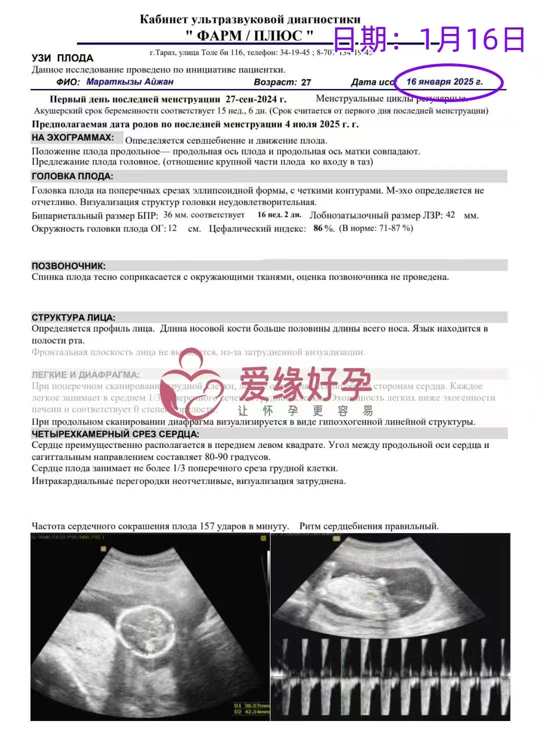 格鲁吉亚爱心使者孕16周产检顺利通过