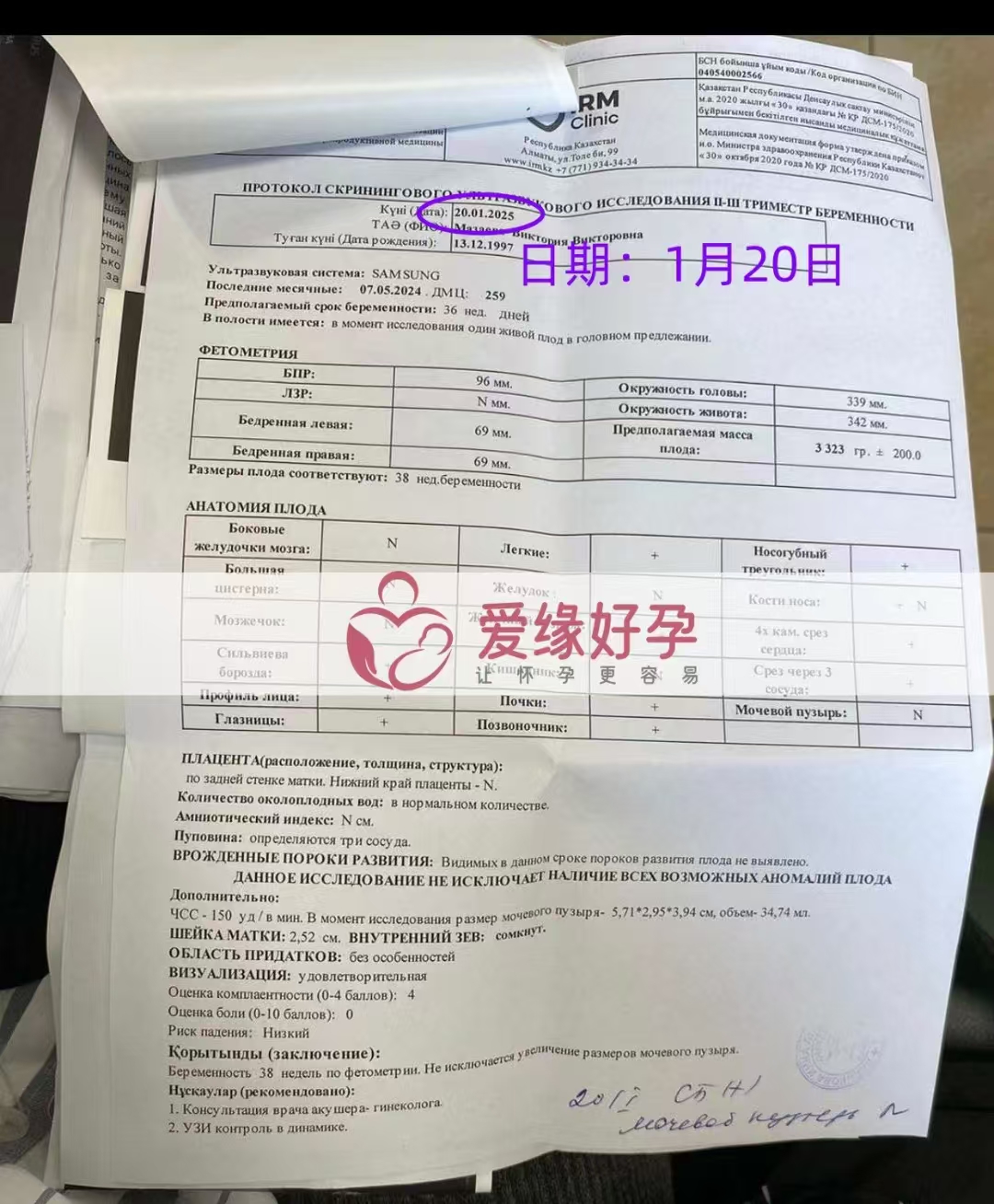 哈萨克斯坦爱心使者孕38周产检顺利通过