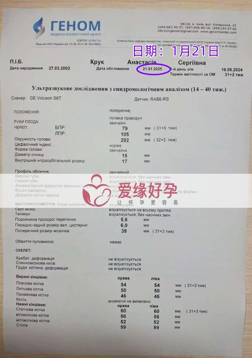 乌克兰爱心使者孕31周产检顺利通过