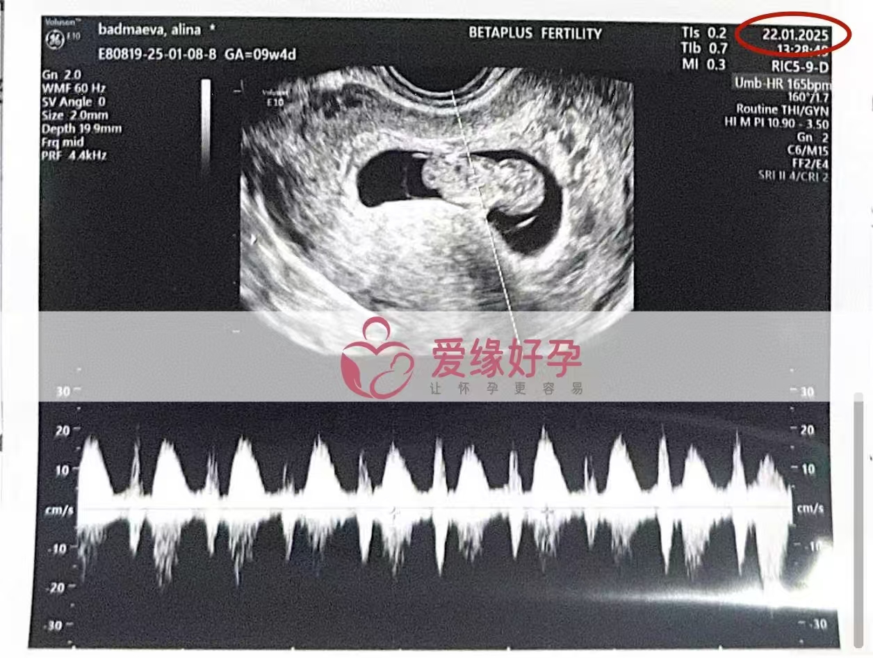 格鲁吉亚爱心使者9周孕检顺利通过，迈向12周关键期