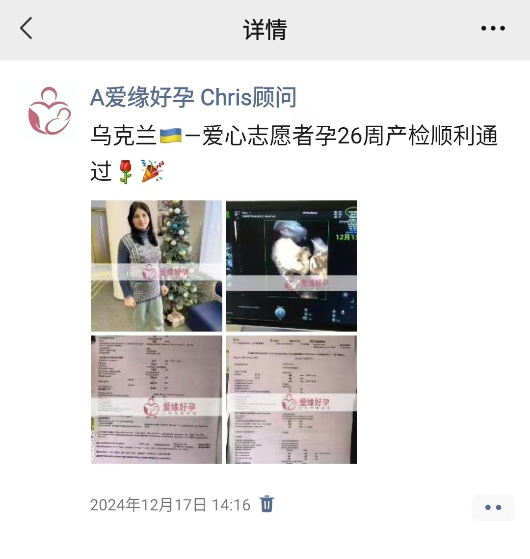 乌克兰试管婴儿助孕爱心使者33周产检顺利通过