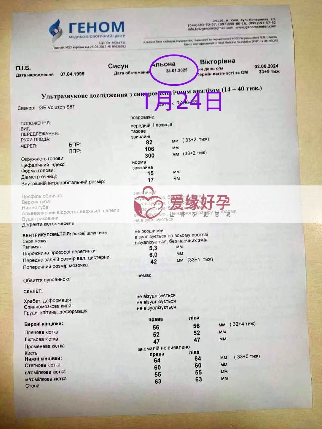 乌克兰试管婴儿助孕爱心使者33周产检顺利通过