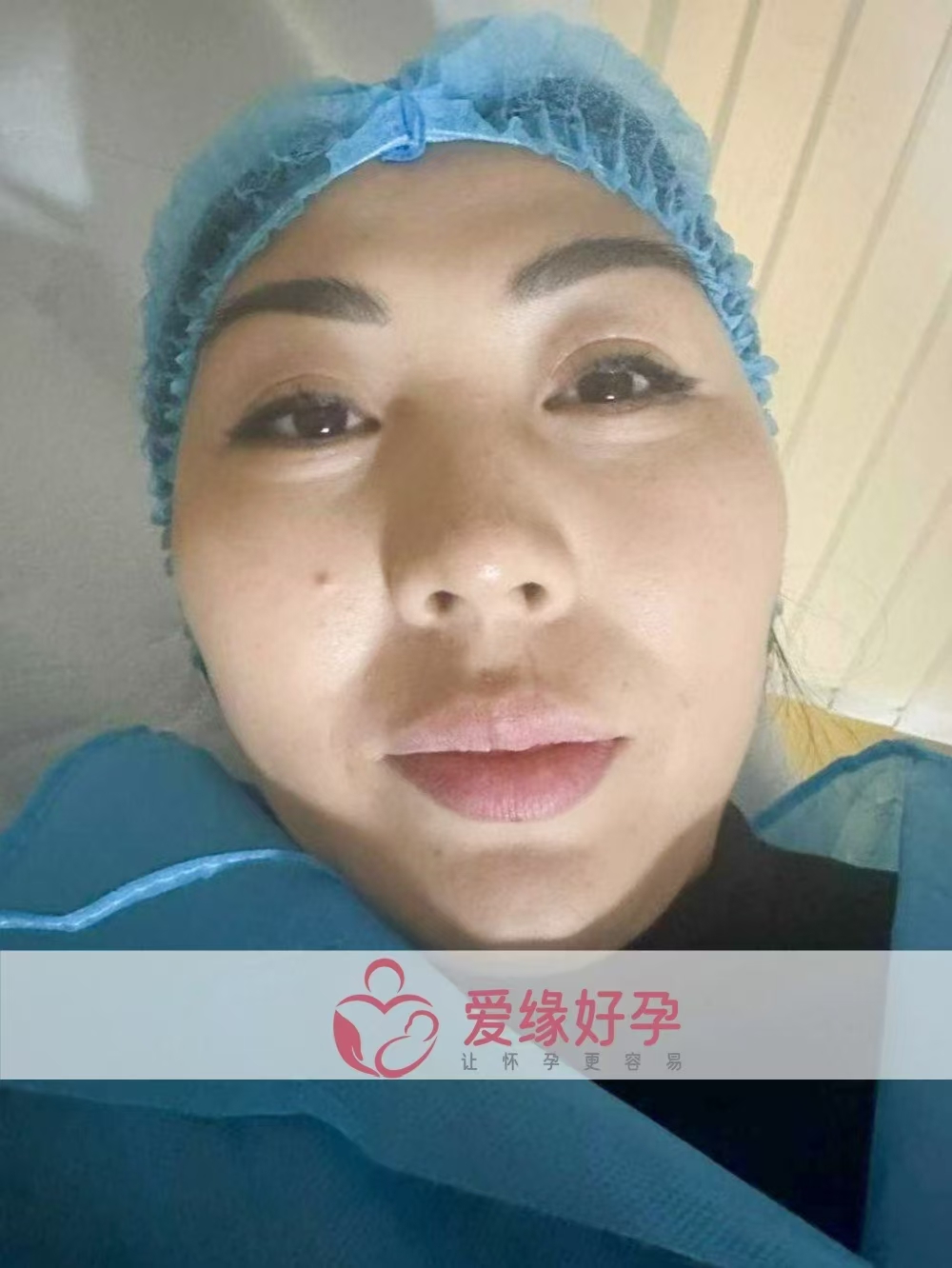 格鲁吉亚试管婴儿助孕爱心使者在Betaplus医院完成胚胎移植