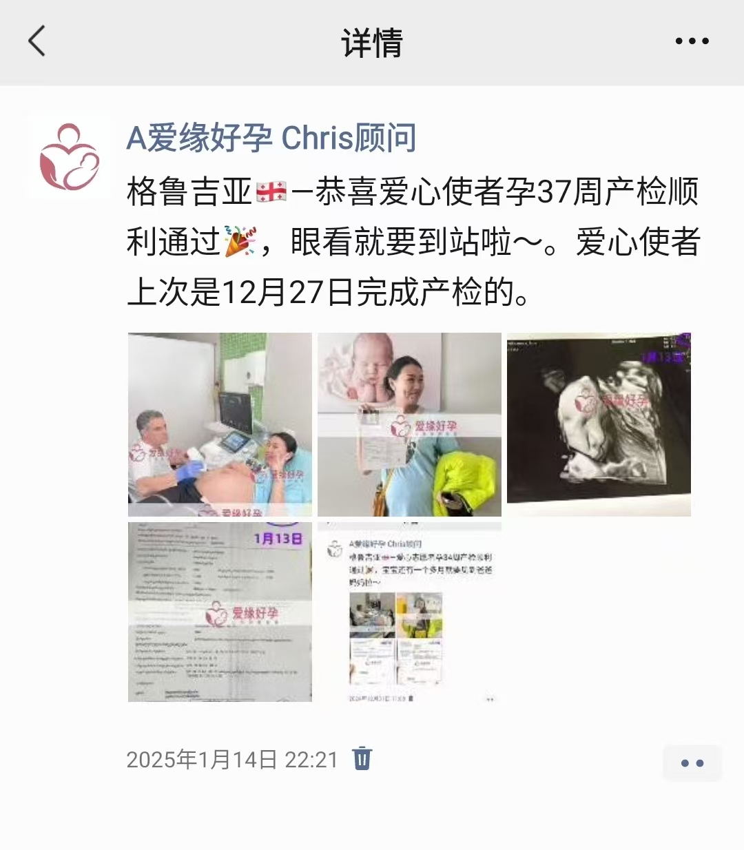 格鲁吉亚试管婴儿助孕小公主39周顺利诞生