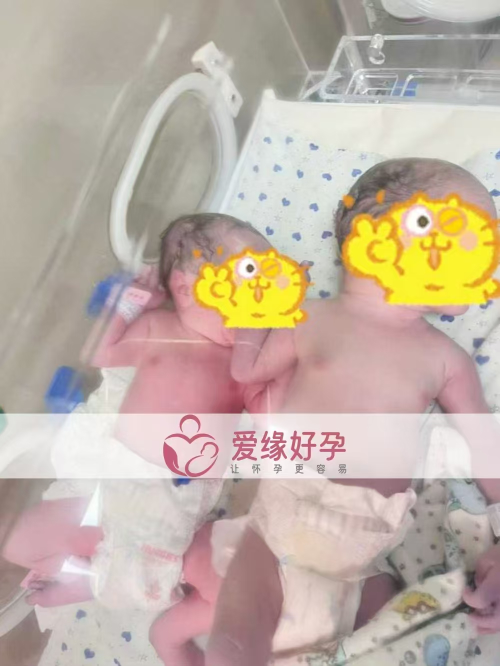 格鲁吉亚试管婴儿助孕恩泽分公司首对龙凤胎顺利诞生