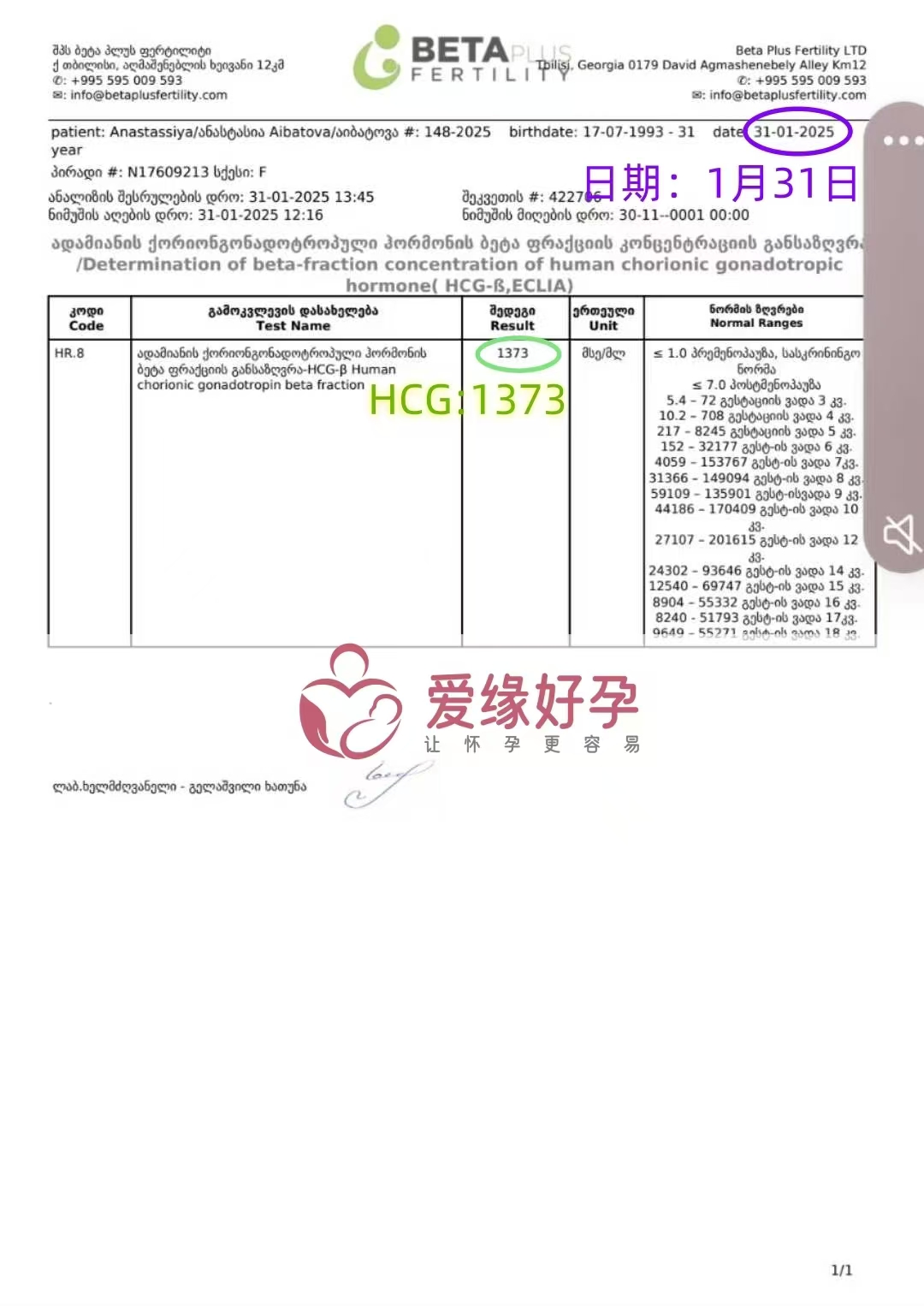 格鲁吉亚试管婴儿助孕爱心使者移植成功