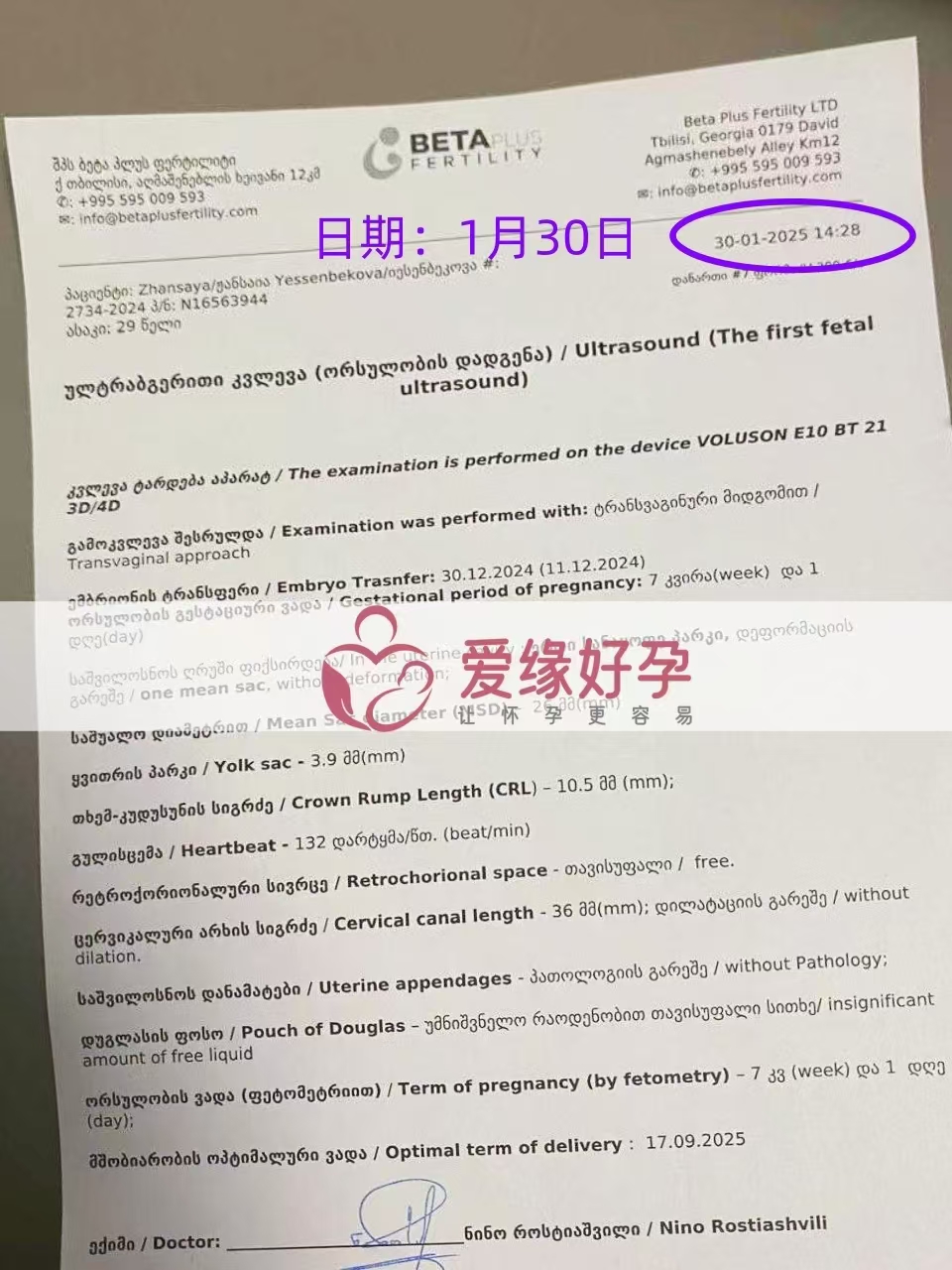 格鲁吉亚试管婴儿助孕爱心使者，新生命迈出第一步