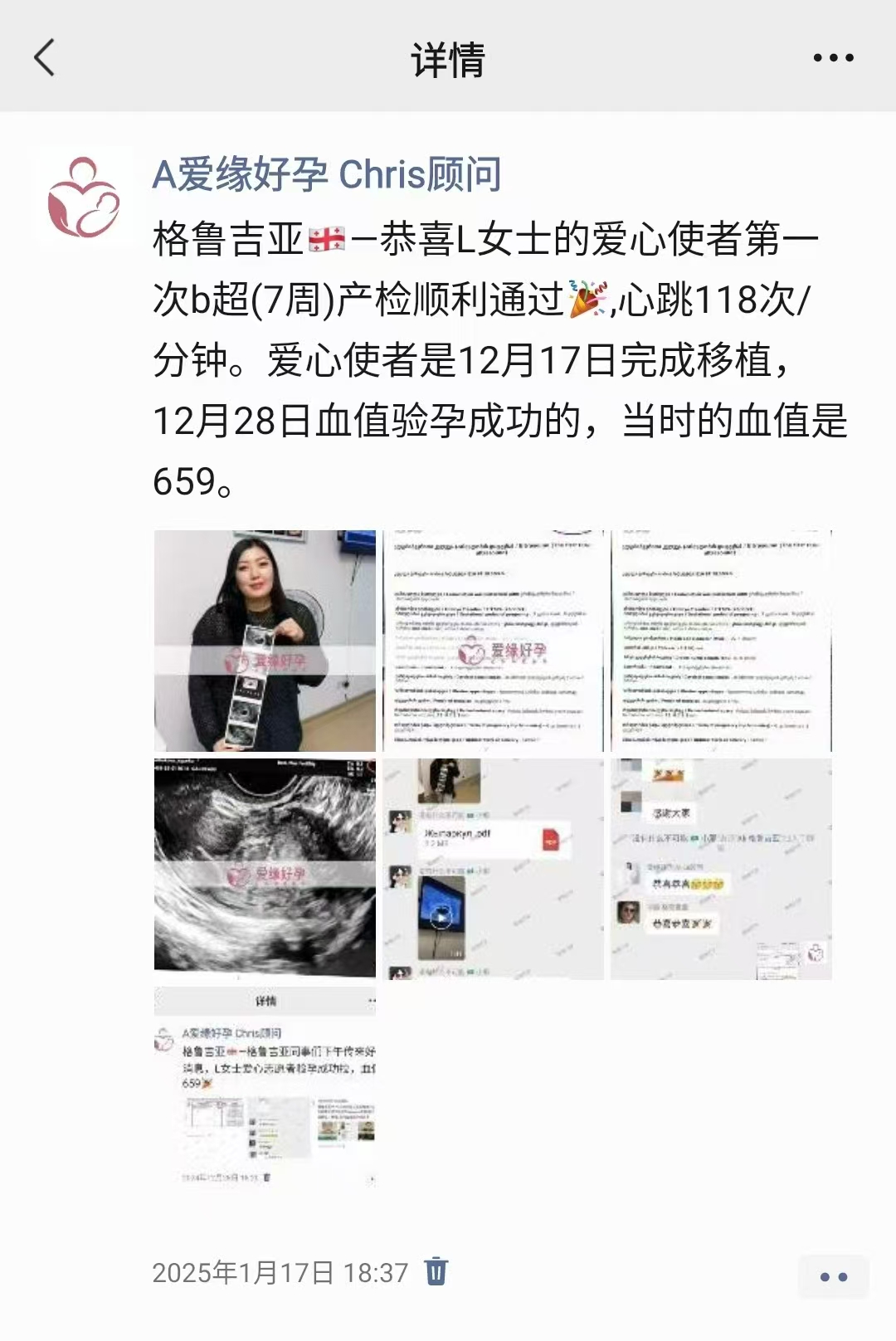 格鲁吉亚试管婴儿助孕爱心使者9周产检顺利