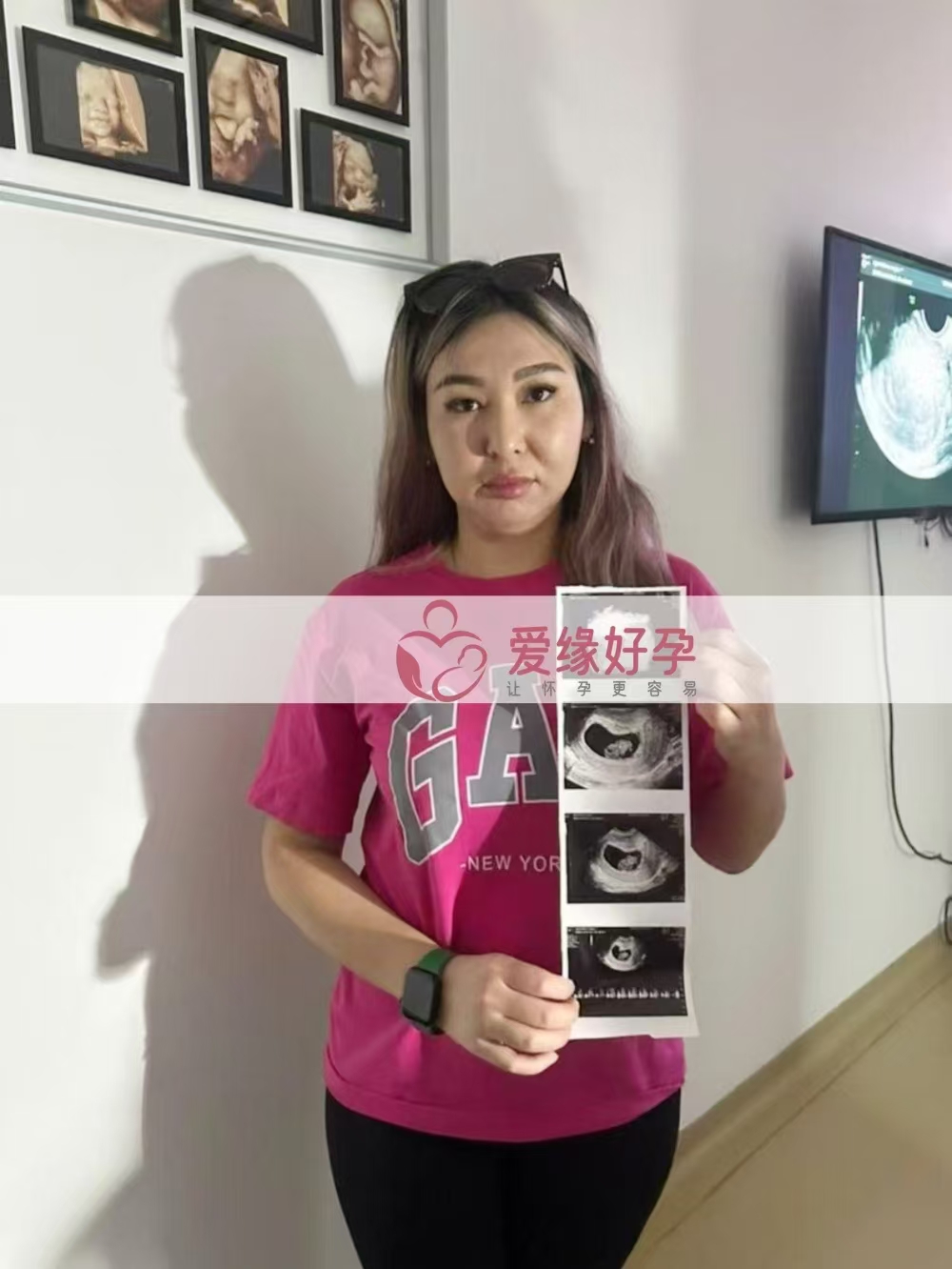 格鲁吉亚试管婴儿助孕爱心使者8周产检顺利通过