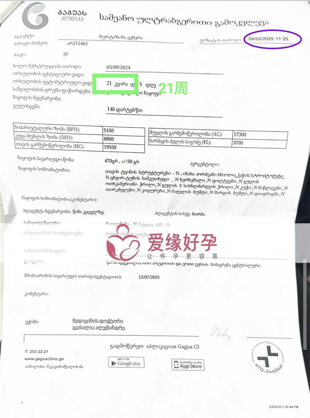 格鲁吉亚试管婴儿助孕爱心使者顺利通过21周产检