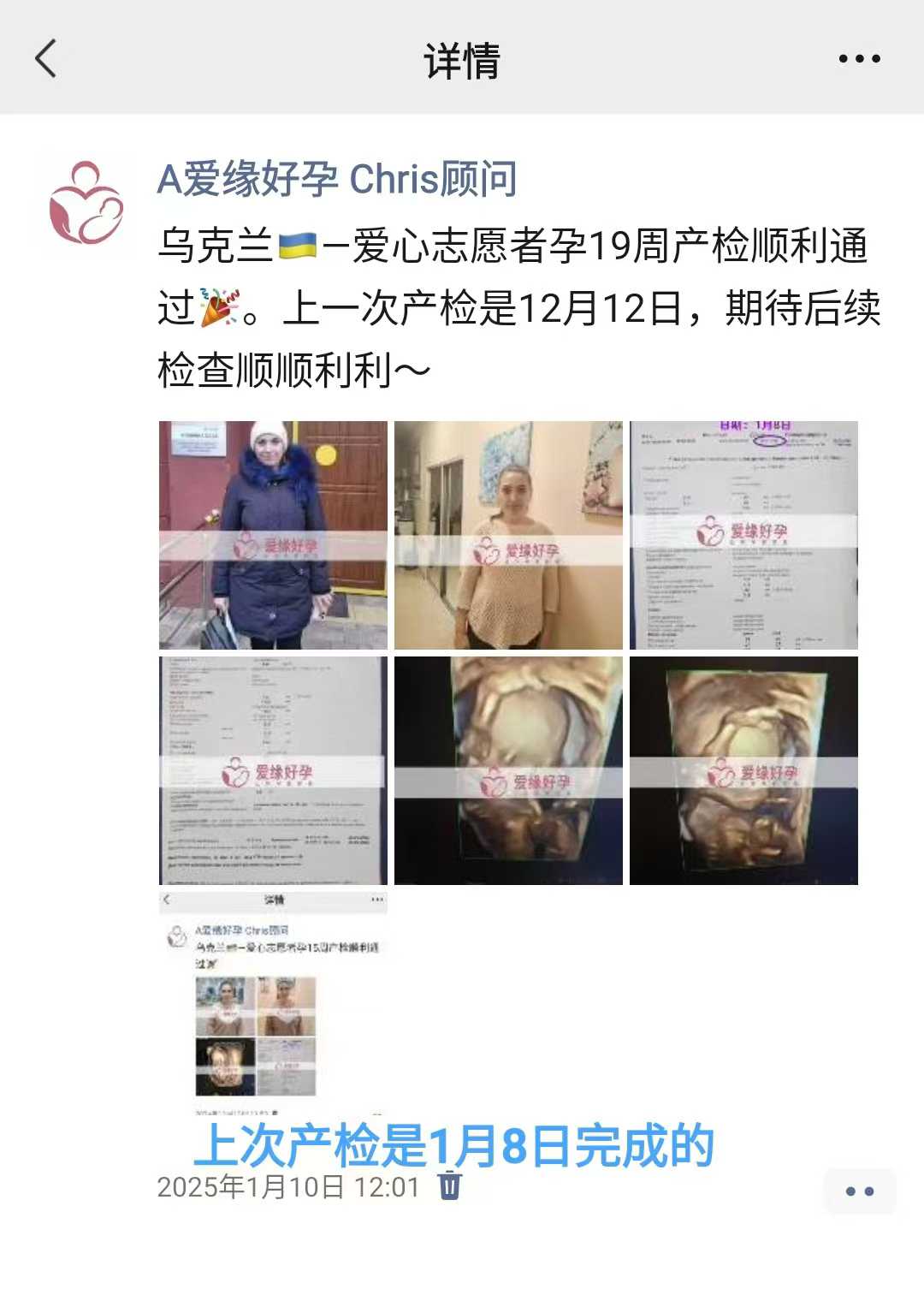 乌克兰试管婴儿助孕爱心使者23周产检顺利通过