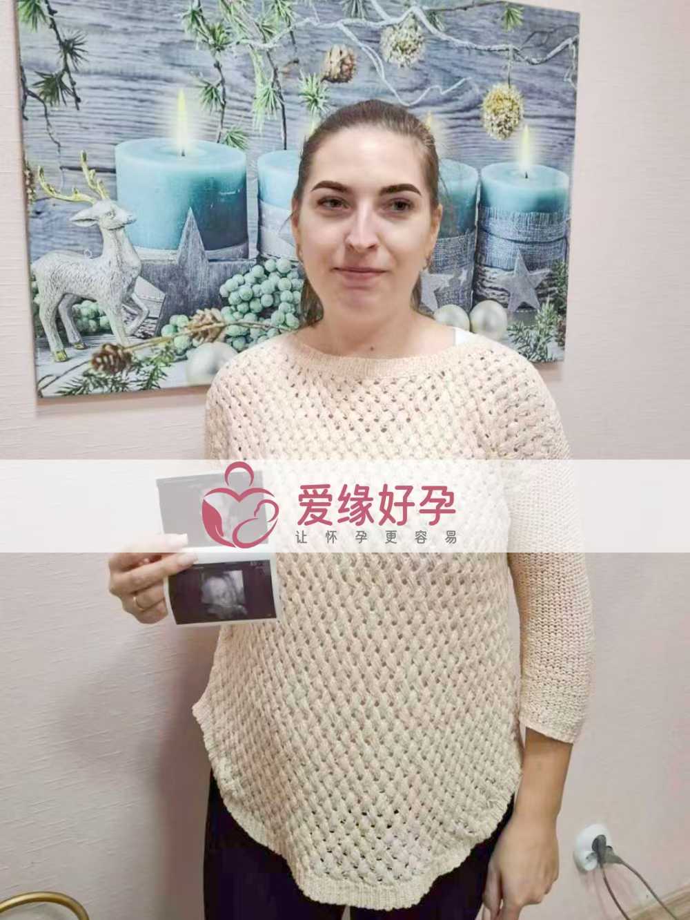 乌克兰试管婴儿助孕爱心使者23周产检顺利通过