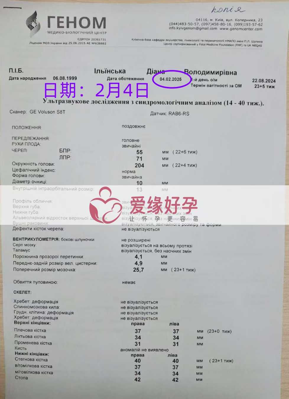 乌克兰试管婴儿助孕爱心使者23周产检顺利通过