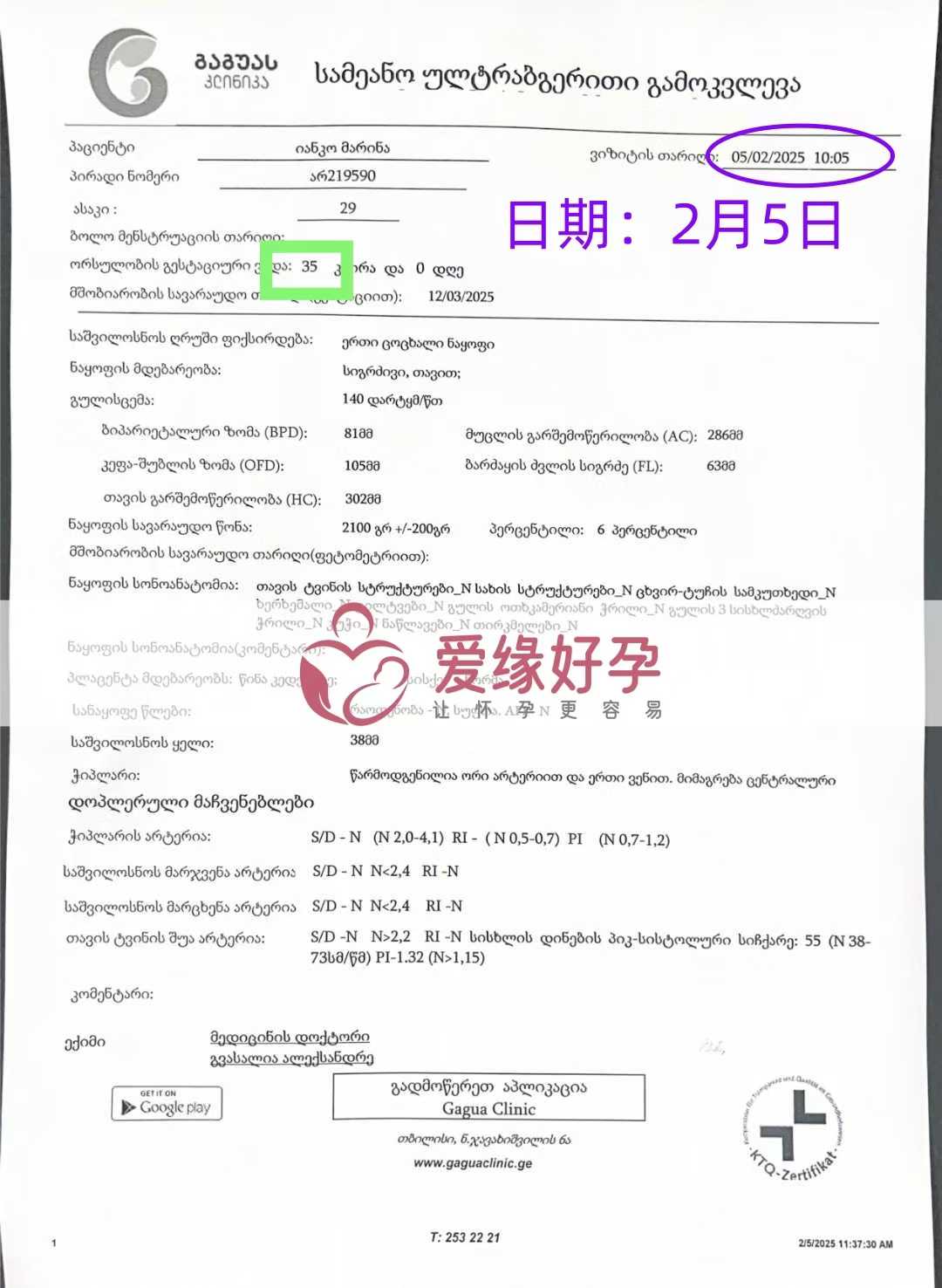 格鲁吉亚试管婴儿助孕爱心使者顺利完成35周产检