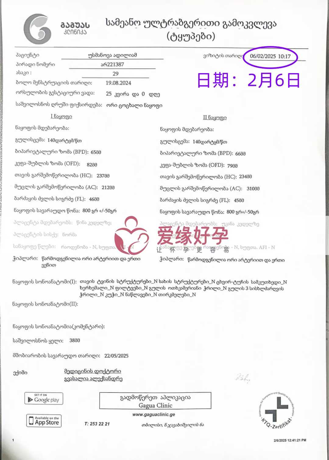 格鲁吉亚试管婴儿助孕爱心使者25周产检顺利通过