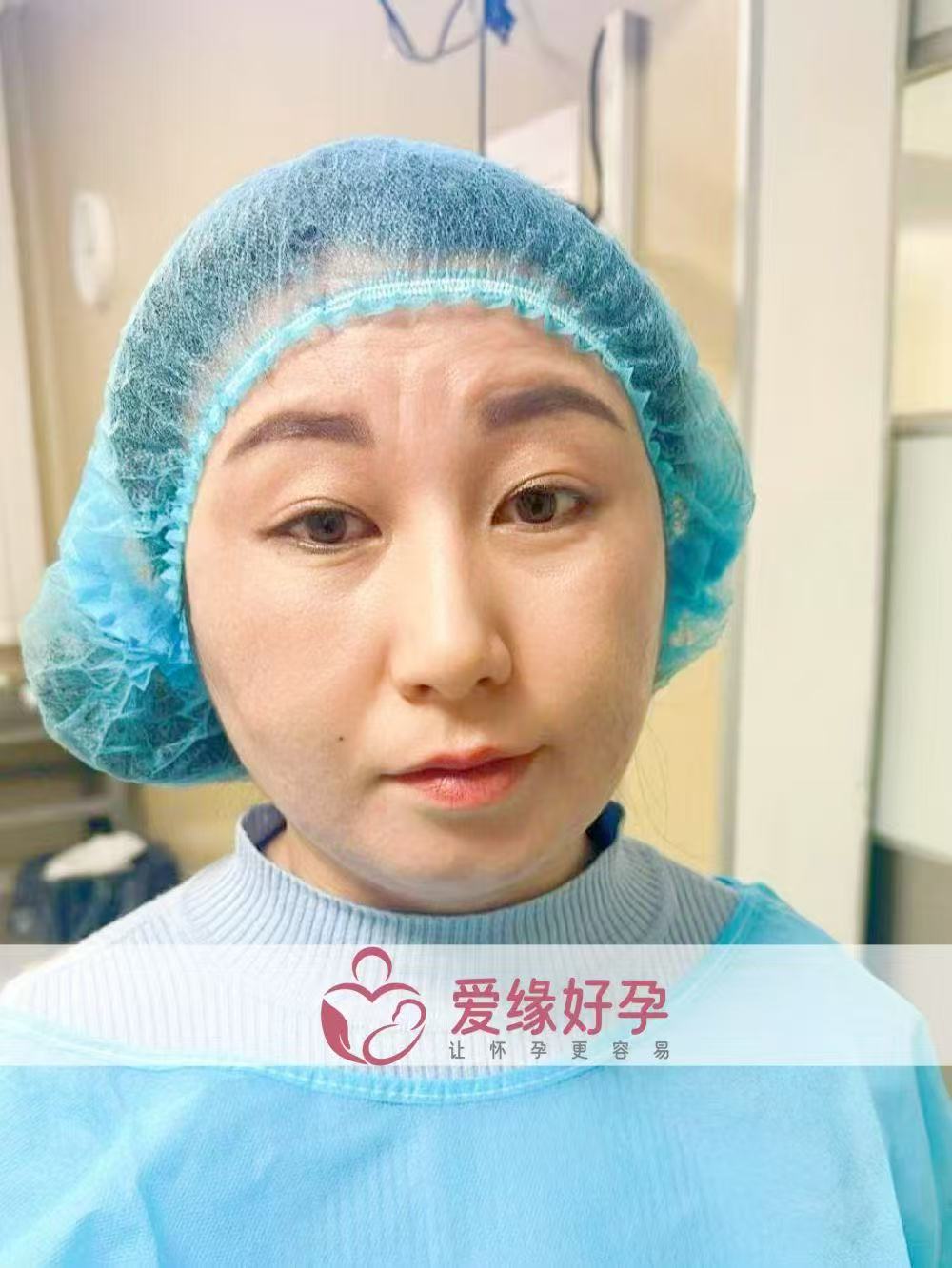 格鲁吉亚试管婴儿助孕爱心使者顺利完成移植