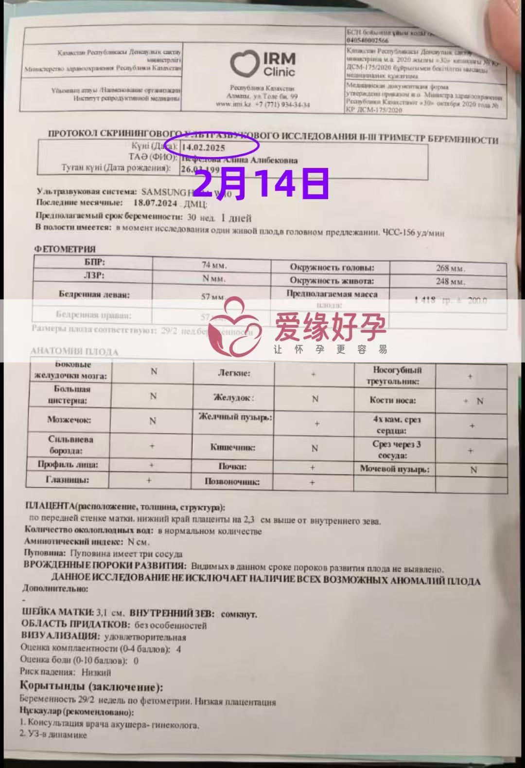 哈萨克斯坦试管婴儿助孕爱心使者30周产检顺利过关