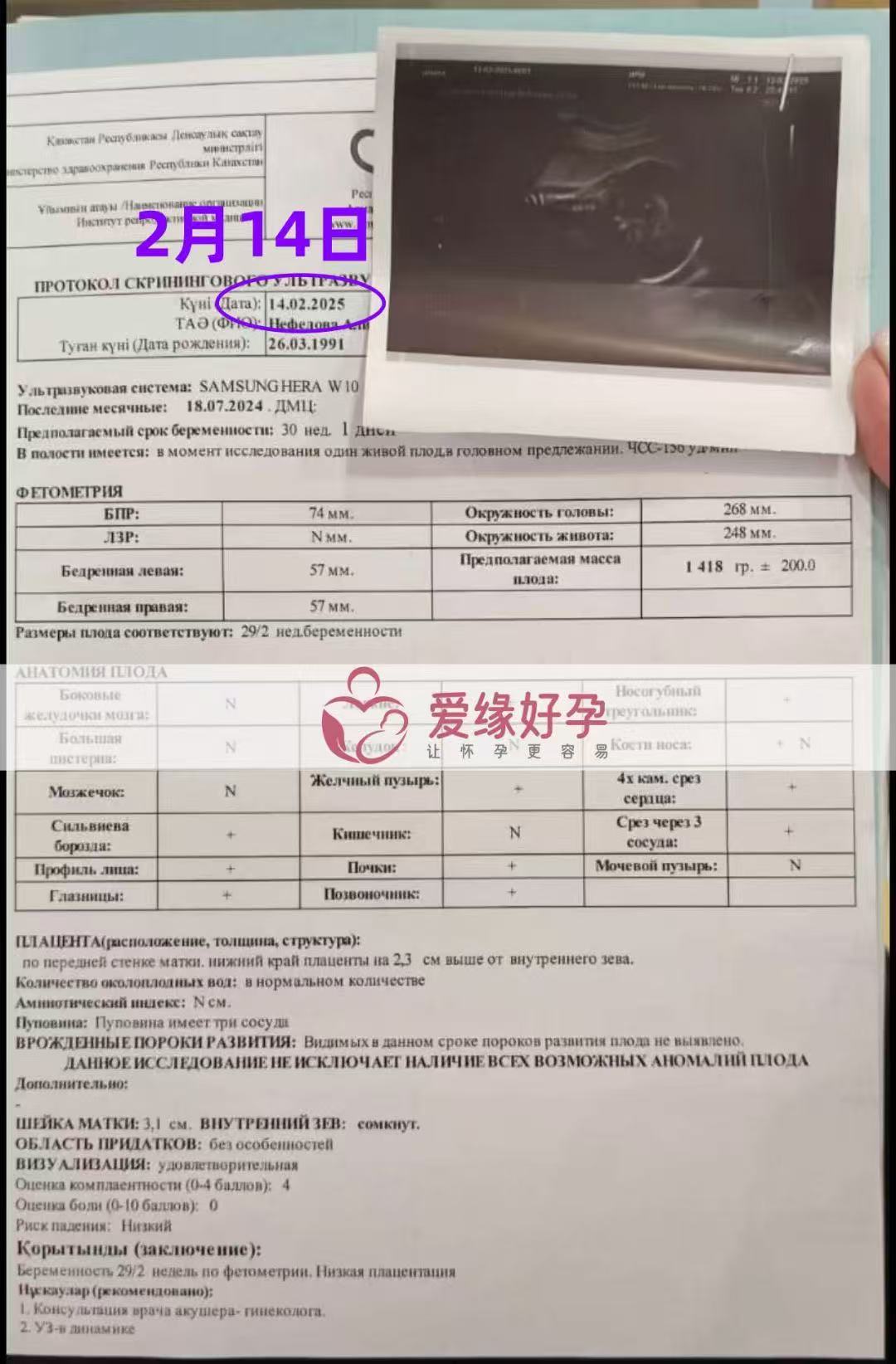 哈萨克斯坦试管婴儿助孕爱心使者30周产检顺利过关