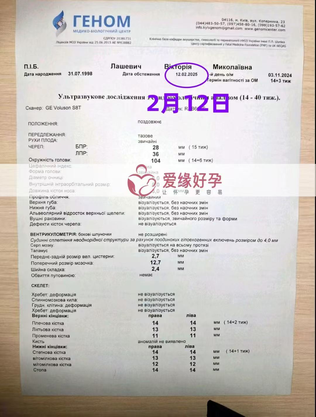 乌克兰试管婴儿助孕爱心使者产检身体恢复正常