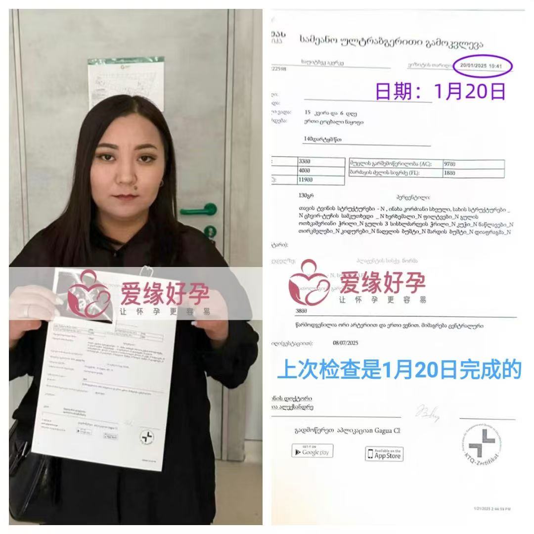 格鲁吉亚试管婴儿助孕爱心使者18周产检顺利通过