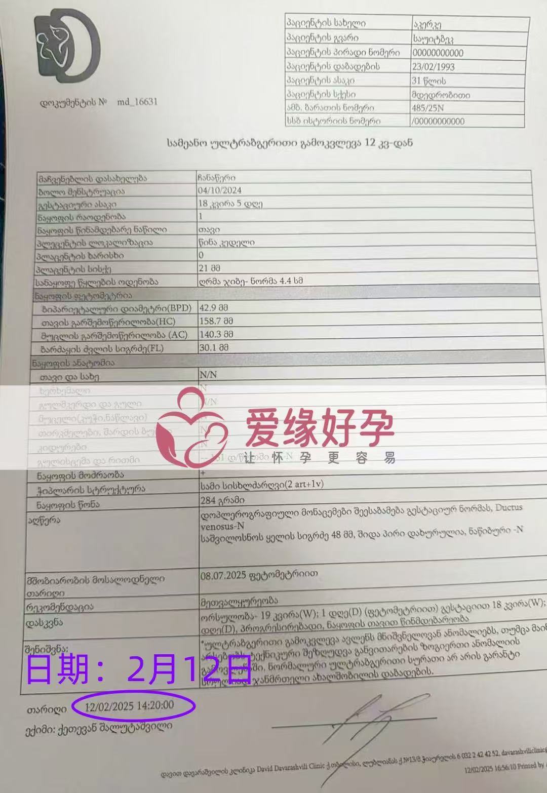 格鲁吉亚试管婴儿助孕爱心使者18周产检顺利通过