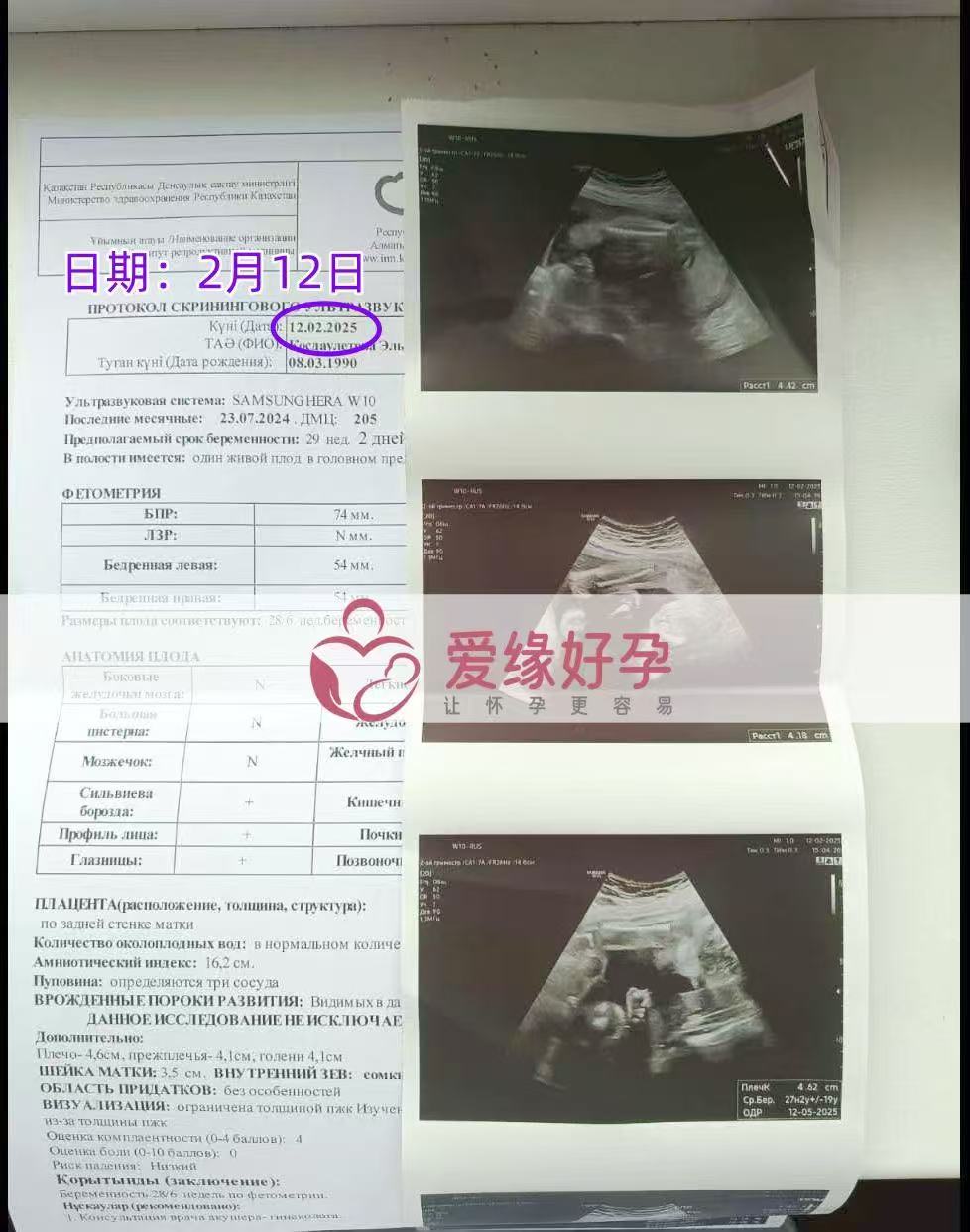 哈萨克斯坦试管婴儿助孕爱心使者29周产检顺利通过