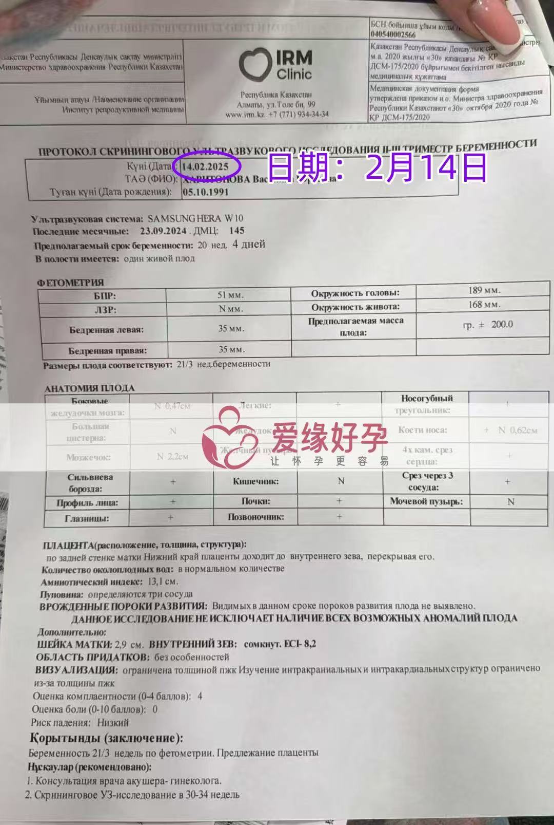 哈萨克斯坦试管婴儿助孕爱心使者20周产检顺利通过