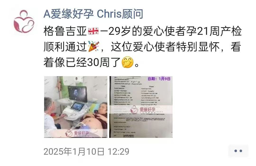 格鲁吉亚试管婴儿助孕爱心使者25周产检顺利通过